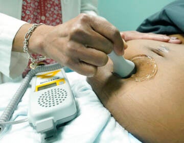 An up-close look at a midwife performing an ultrasound.