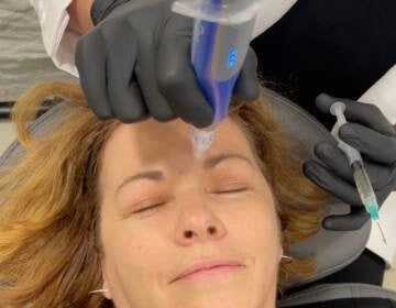 The Pulse host Maiken Scott receives a microneedling treatment based on stem cells that's designed to stimulate collagen and elastin production in the skin. (Courtesy of Maiken Scott)