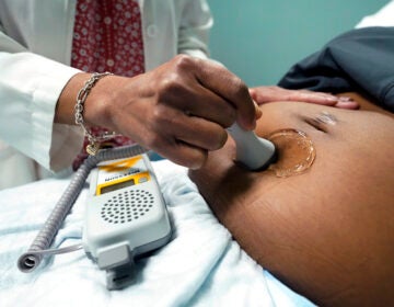 A doctor uses a hand-held Doppler probe on a pregnant woman